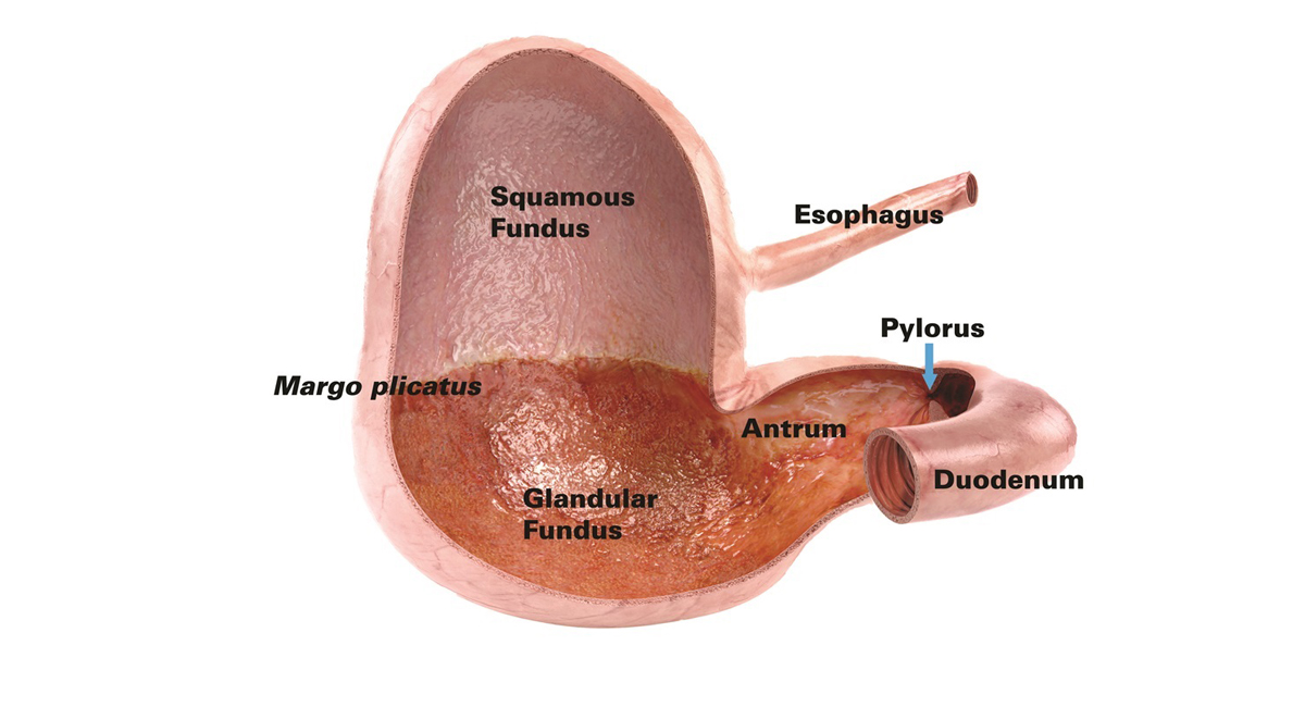 equine gastric ulcer syndrome (EGUS)