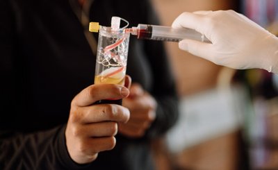Gloved veterinary professional preparing a blood-derived regenerative medicine product.